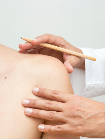 dermatoscopia in preventia cancerului de piele
